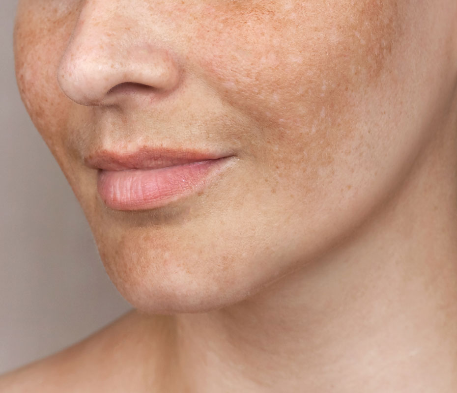 Montrose London - Aging face