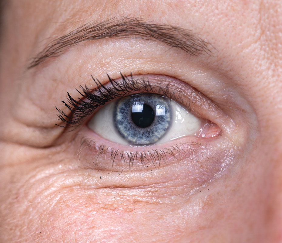 Montrose London - Crow’s Feet