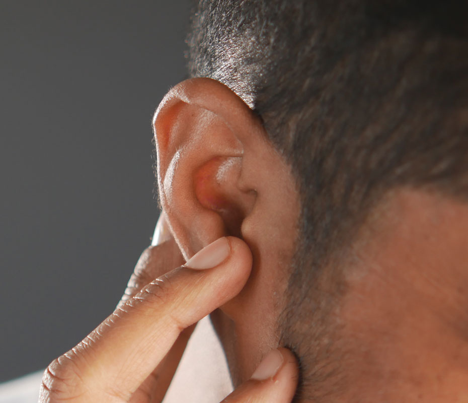 Montrose London - Split earloab