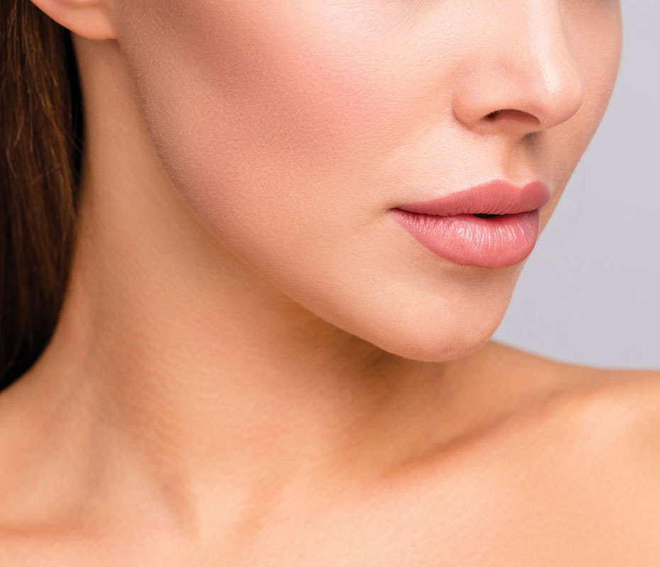 Montrose London - Cheek Filler