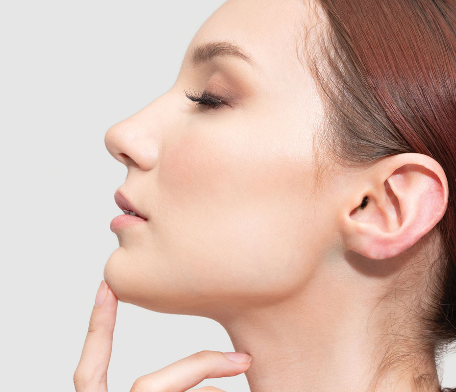 Montrose London - Chin Filler