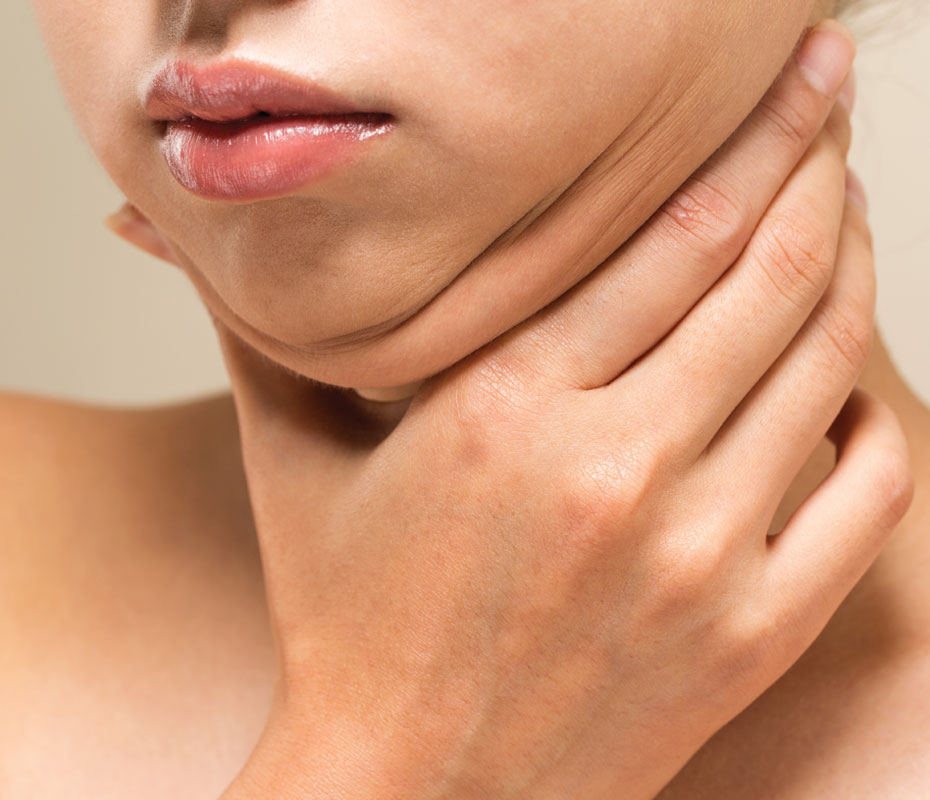 Montrose London - Double Chin