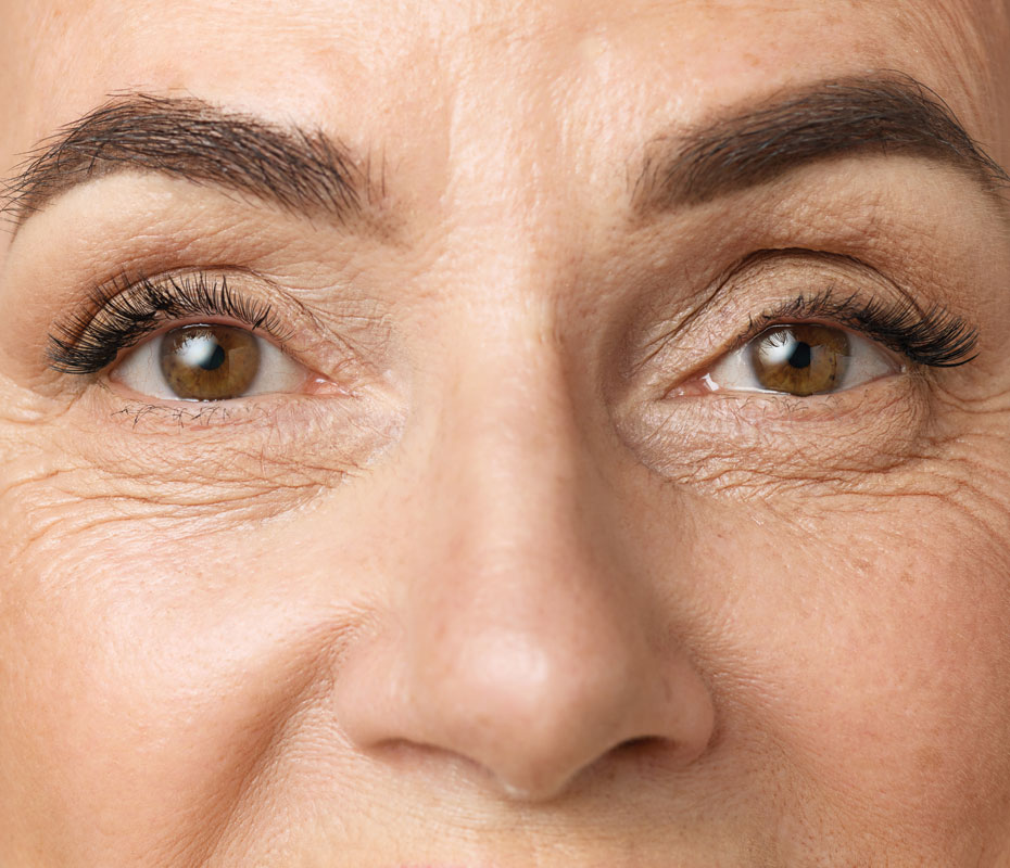 Montrose London - Facial Volume Loss