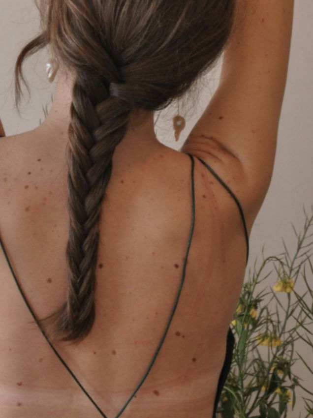 Could That Mole Be Skin Cancer?